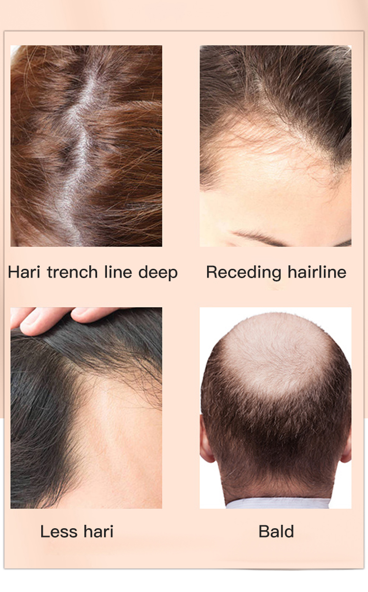 anti hair loss hair growth